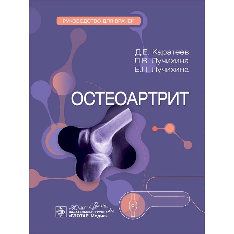 Остеоартрит: руководство для врачей