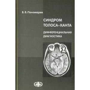 Синдром Толоса-Ханта. Дифференциальная диагностика (случаи из практики). Руководство для врачей Синдром Толоса-Ханта. Дифференциальная диагностика (случаи из практики). Руководство для врачей