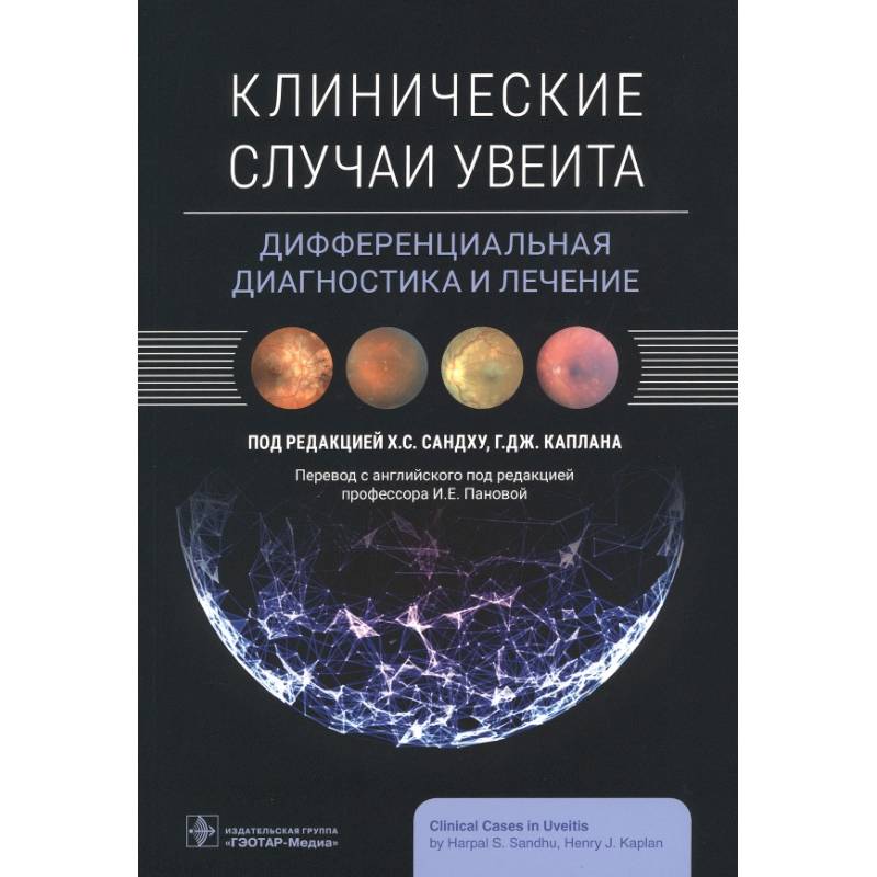 Клинические случаи увеита. Дифференциальная диагностика и лечение