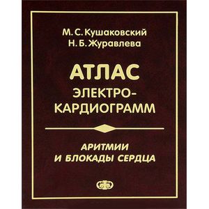 Аритмии и блокады сердца. Атлас электрокардиограмм