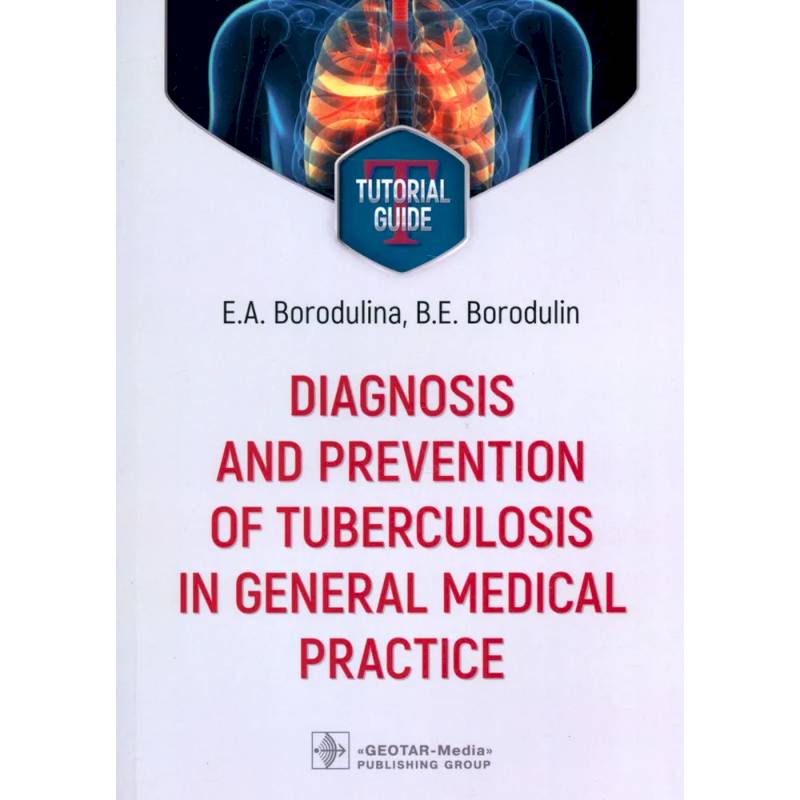 Diagnosis and prevention of tuberculosis in general medical practice: tutorial guide = Диагностика и профилактика туберкулеза в общей врачебной практи