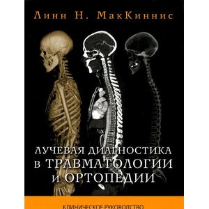 Лучевая диагностика в травматологии и ортопедии
