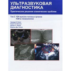 Ультразвуковая диагностика. Практическое решение клинических проблем. В 5 томах. Том 2. УЗИ мужских половых органов. УЗИ в гинекологии