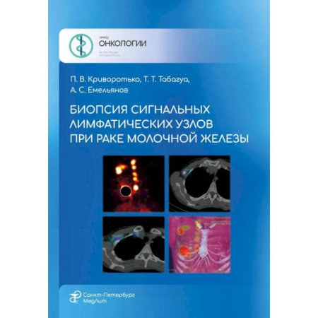 Онкология, книга Биопсия сигнальных лимфатических узлов при раке молочной железы купить по скидке