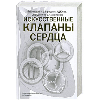 Искусственные клапаны сердца