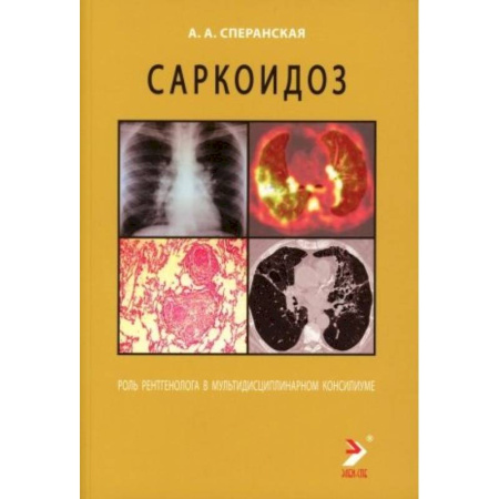 Медицинские энциклопедии и справочники, книга Саркоидоз. Роль ренгенолога в мультидисциплинарном консилиуме купить по скидке