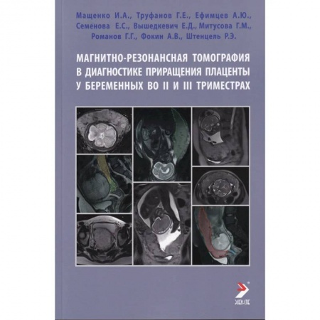 УЗИ. ЭКГ. Томография. Рентген, книга Магнитно-резонансная томография в диагностике приращения плаценты у беременных во II и III триместрах купить по скидке