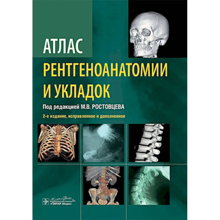 УЗИ. ЭКГ. Томография. Рентген, книга Атлас рентгеноанатомии и укладок: руководство для врачей купить по скидке