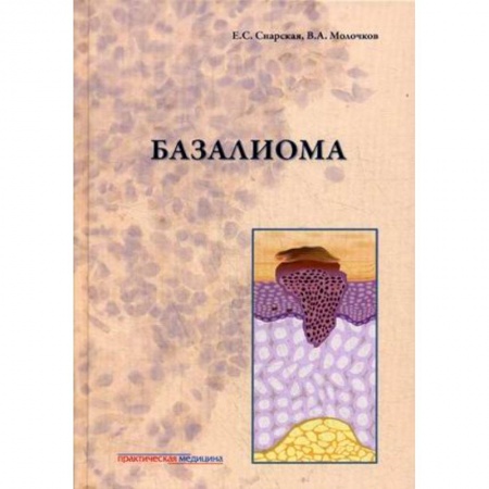 Онкология, книга Базалиома купить по скидке