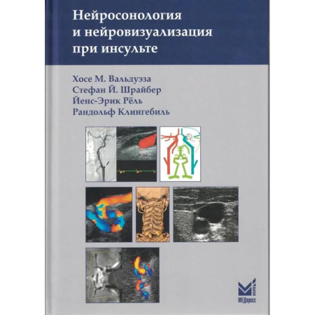 Кардиология, книга Нейросонология и нейровизуализация при инсульте купить по скидке