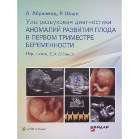 УЗИ. ЭКГ. Томография. Рентген, книга Ультразвуковая диагностика аномалий развития плода в первом триместре беременности купить по скидке