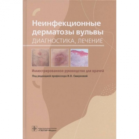 Медицинские энциклопедии и справочники, книга Неинфекционные дерматозы вульвы. Диагностика, лечение. Иллюстрированное руководство купить по скидке