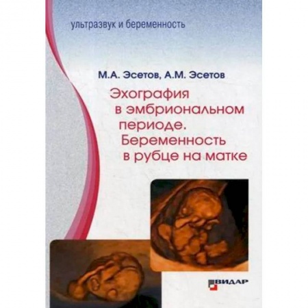 Акушерство и гинекология, книга Эхография в эмбриональном периоде. Беременность в рубце на матке купить по скидке