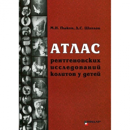 УЗИ. ЭКГ. Томография. Рентген, книга Атлас рентгеновских исследований колитов у детей купить по скидке