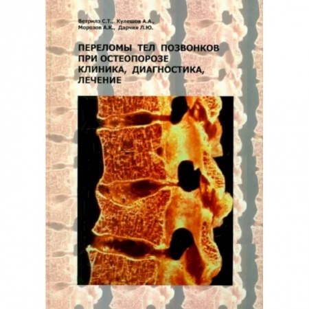 Хирургия. Ортопедия, книга Переломы тел позвонков при остеопорозе. Клиника, диагностика, лечение купить по скидке