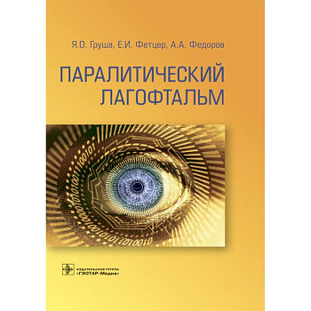 Паралитический лагофтальм