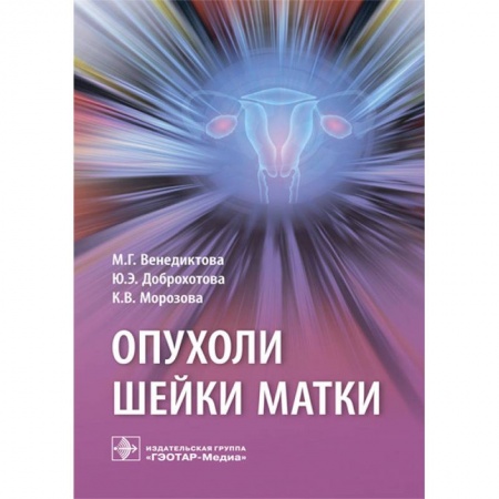 Акушерство и гинекология, книга Опухоли шейки матки купить по скидке