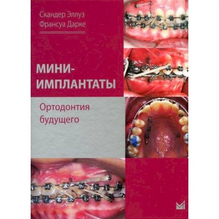 Стоматология, книга Мини-имплантаты. Ортодонтия будущего купить по скидке