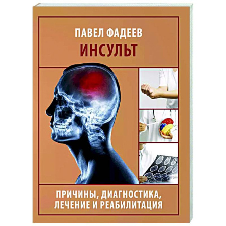 Кардиология, книга Инсульт. Причины, диагностика, лечение и реабилитация купить по скидке
