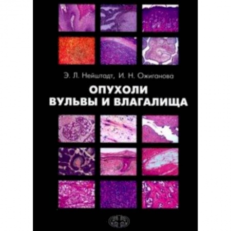 Акушерство и гинекология, книга Опухоли вульвы и влагалища купить по скидке