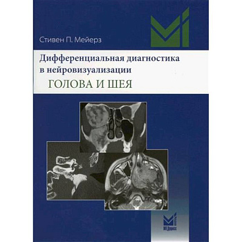 Дифференциальная диагностика в нейровизуализации. Голова и шея
