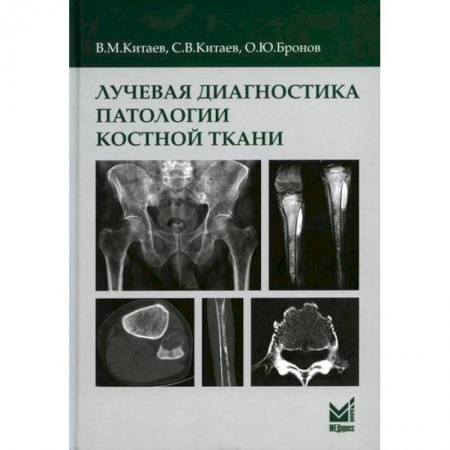 УЗИ. ЭКГ. Томография. Рентген, книга Лучевая диагностика патологии костной ткани купить по скидке