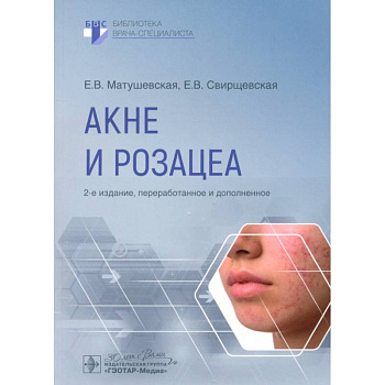 Акне и розацеа