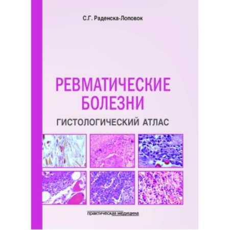 Медицинские энциклопедии и справочники, книга Ревматические болезни. Гистологический атлас купить по скидке