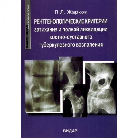 УЗИ. ЭКГ. Томография. Рентген, книга Рентгенологические критерии затихания и полной ликвидации костно-суставного туберкулезного воспаления купить по скидке