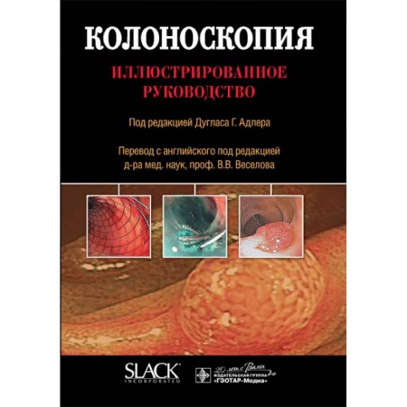 Гастроэнтерология, книга Колоноскопия. Иллюстрированное руководство купить по скидке