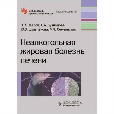 Диагностика и лечение, книга Неалкогольная жировая болезнь печени купить по скидке