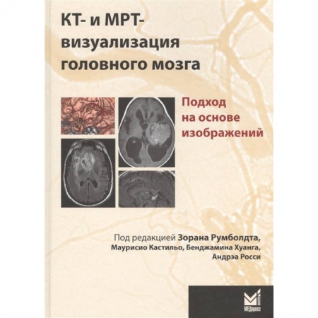 Медицинские энциклопедии и справочники, книга КТ- и МРТ- визуализация головного мозга. Подход на основе изображений купить по скидке