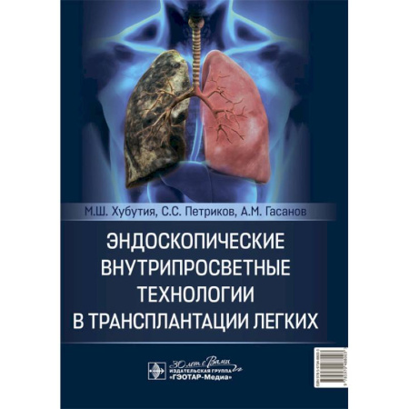 Здоровье, медицинская литература, книга Эндоскопические внутрипросветные технологии в трансплантации легких купить по скидке