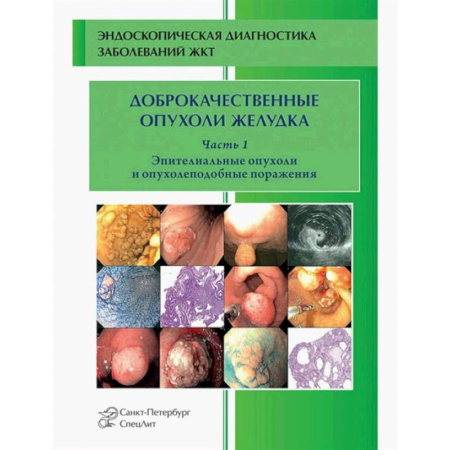 Онкология, книга Доброкачественные опухоли желудка. Часть1: Эпителиальные опухоли и опухолеподобные поражения: Учебно-методическое пособие купить по скидке